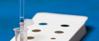 Express,Used,Hiv,Test,Using,Blood,From,A,Finger,Macro STD测试